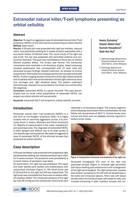 Pdf Extranodal Natural Killer T Cell Lymphoma Presenting As Orbital