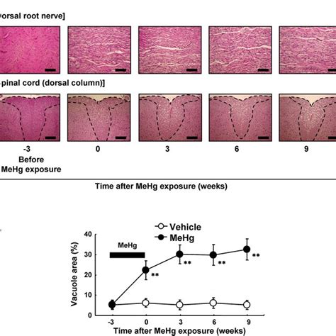 Schematic Representation Of The Potential Mechanism In MeHg Induced