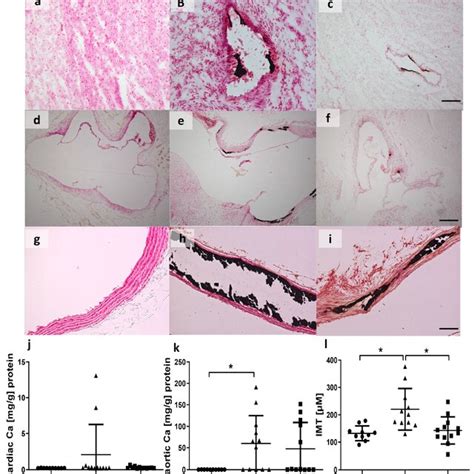 Von Kossa Staining Of Aortas And Hearts Visualized An Increase In Soft Download Scientific