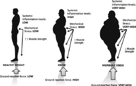 Can Being Overweight Cause Back Pain Cares Healthy