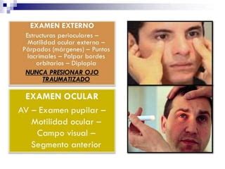 Trauma Ocular Abierto PPT