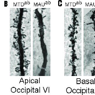 Golgi Stained Dendrites A Basal Dendrites In Frontal Cortex Layer V