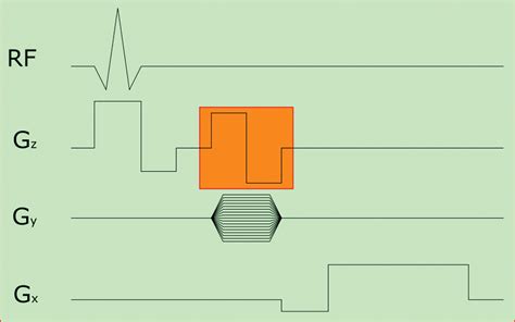 Phase Contrast Mri Physics Techniques And Clinical Applications