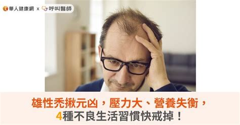 雄性禿揪元凶，壓力大、營養失衡，4種不良生活習慣快戒掉！ 蕃新聞