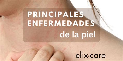 ℹ️ Principales Enfermedades De La Piel