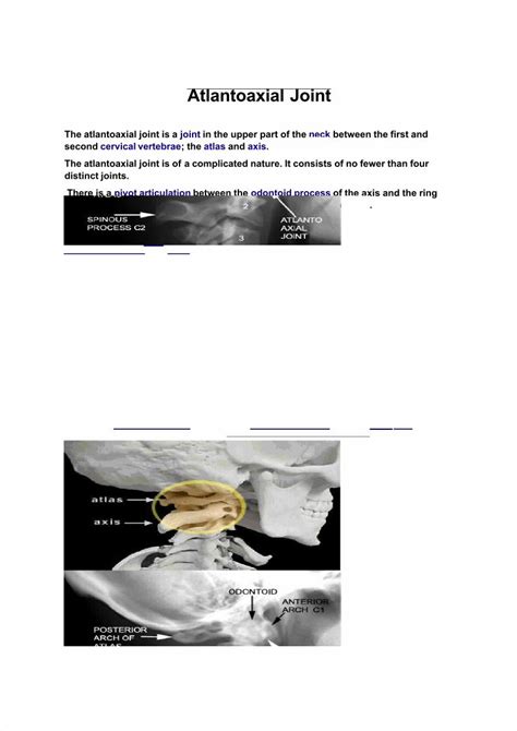 (PDF) Atlantoaxial Joint - DOKUMEN.TIPS