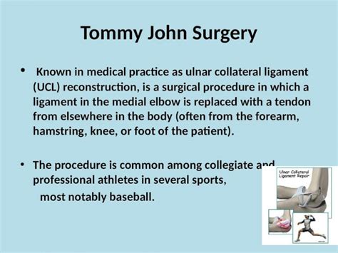 Pptx Tommy John Surgery Known In Medical Practice As Ulnar Collateral Ligament Ucl