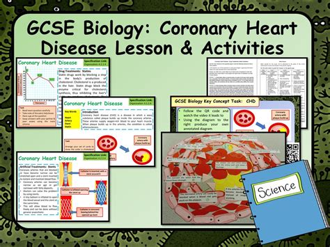 KS4 AQA GCSE Biology Science Coronary Heart Disease CHD Lesson