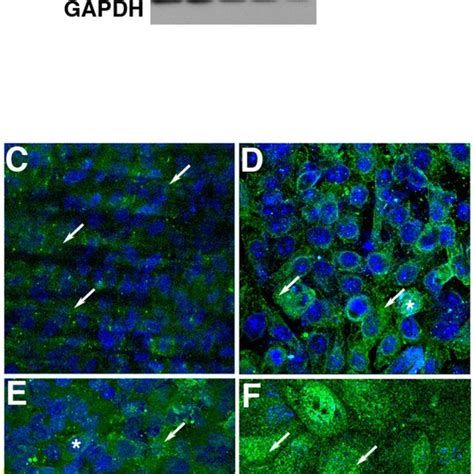 Lysates Of The Human Rpe Cell Lines Arpe 19 A Lane 1 And D407 A