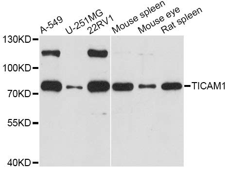 Anti-TICAM1 / TRIF Antibody | Rabbit anti-Human Polyclonal IHC,WB | LSBio