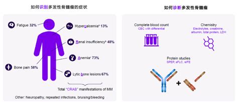 部分多发性骨髓瘤的确诊长达150天如何缩短诊断周期 腾讯新闻