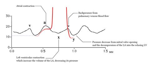 The Cardiac Cycle Deranged Physiology