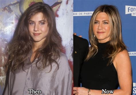 Jennifer Aniston Plastic Surgery Before and After Photos