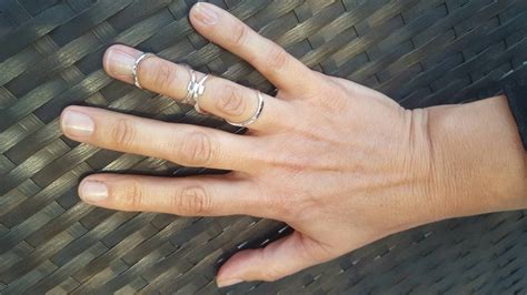 Eds Hypermobility Double Knuckle Silver Ring Splint Etsy