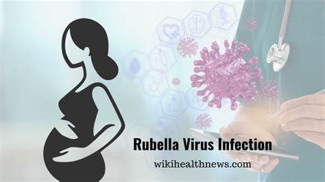 Rubella Virus Infection Symptoms And Prevention Wiki Health News