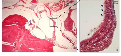 Figure From Expression And Localization Of Bdnf Trkb System In The