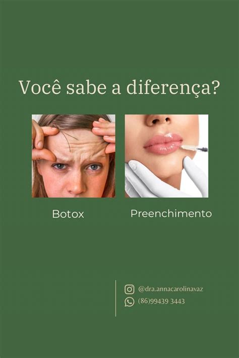 Descubra As Diferenças Entre Botos E Preenchimento Na Dermatologia Estética E Saiba Qual é O