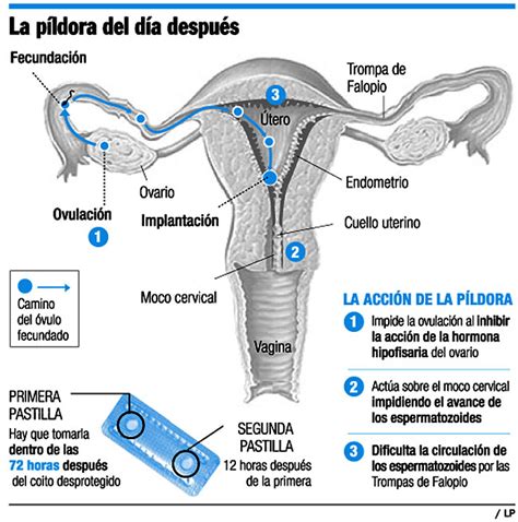 La Pastilla Del Día Después