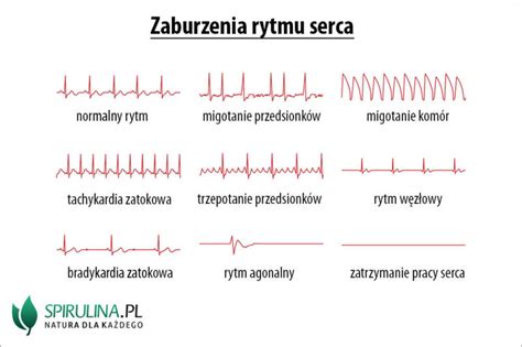 Zaburzenia Rytmu Serca Algi Spirulina I Chlorella