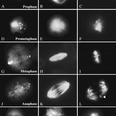 The Gfp Motorless Deletion Exhibits A Lagging Chromosome Phenotype At