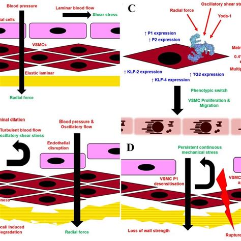 Illustration Of VSMC Phenotypes A Contractile Phenotype And B