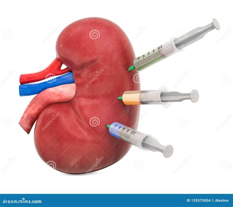 Treatment of Kidney Disease Concept, 3D Rendering Stock Illustration ...