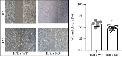 KDM3A Knockout Exaggerated H R Induced CMEC Injury And Dysfunction A