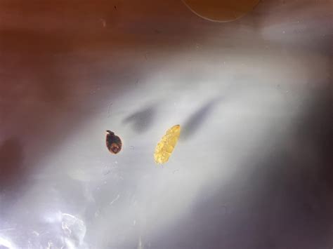 Are these bed bug eggs? : r/Bedbugs