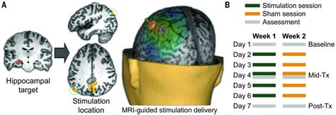 Targeted Enhancement Of Cortical Hippocampal Brain Networks And