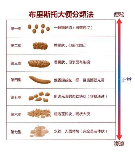 7种异常大便颜色，上完厕所别忘看一眼！表面