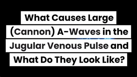 What Causes Large Cannon A Waves In The Jugular Venous Pulse And What