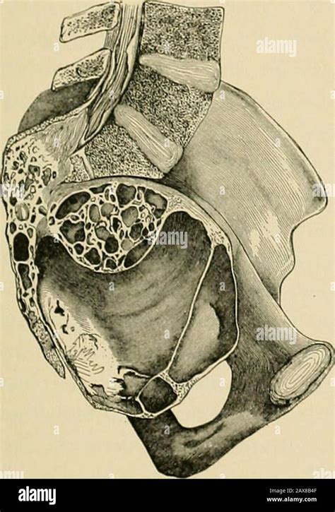 Ala Anatomy