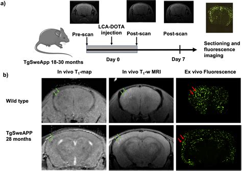 Contrast Enhanced Magnetic Resonance Imaging Of Amyloid β Plaques In A