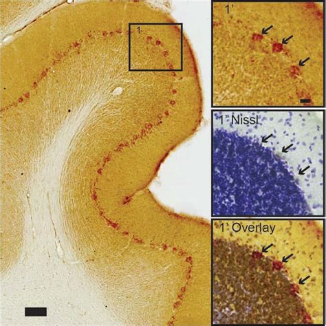 Cerebellar Purkinje Neurons Contain High Levels Of IA 42 In Stark