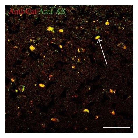 Double Labeling Immunofluorescence Demonstrating Colocalization Of Download Scientific Diagram