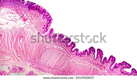 385 Cardia Stomach Royalty-Free Photos and Stock Images | Shutterstock