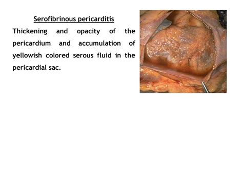 Pathophysiology Of Cardiovascular System Ppt Download