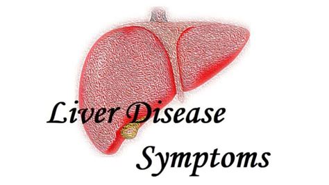 11 Liver Disease Symptoms - Don't Underestimate It! » 2024