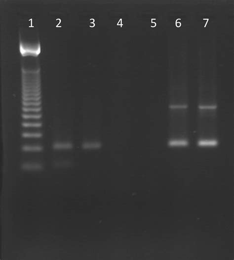 Amelogenin Pcr Gel Electrophoretic Separation Of Products On 3 Download Scientific Diagram