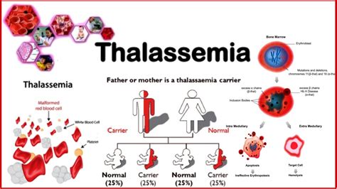 What Is Thalassemia Eduindex News