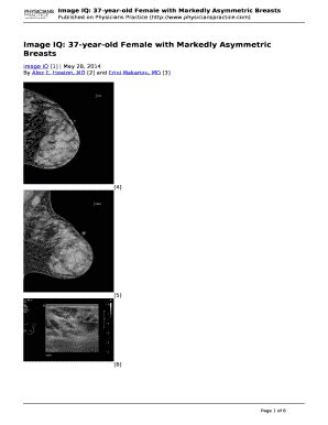 Fillable Online Image IQ 37 Year Old Female With Markedly Asymmetric