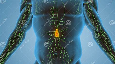 Cancer of the Lymphatic System Caused by Lymphomas Stock Photo - Image of anatomy, cell: 304917034