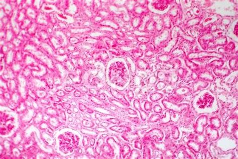 Histology of human kidney ~ Premium Stock Photo #85432959