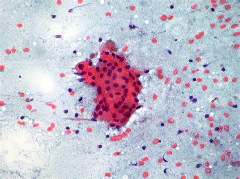 Salivary Glands Cytopathology Cellnetpathology