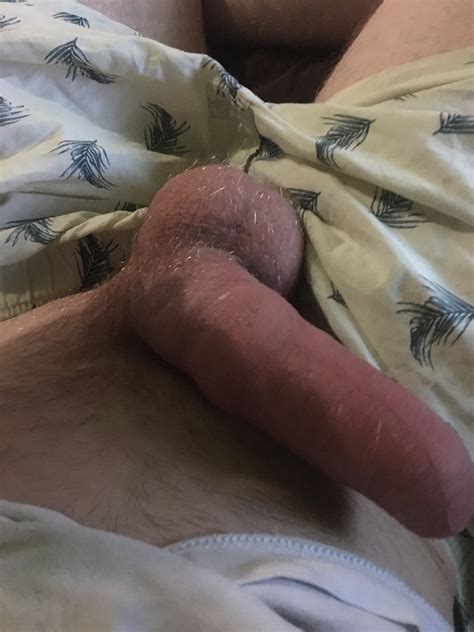 Pumped Cock And Balls 54 Pics Xhamster