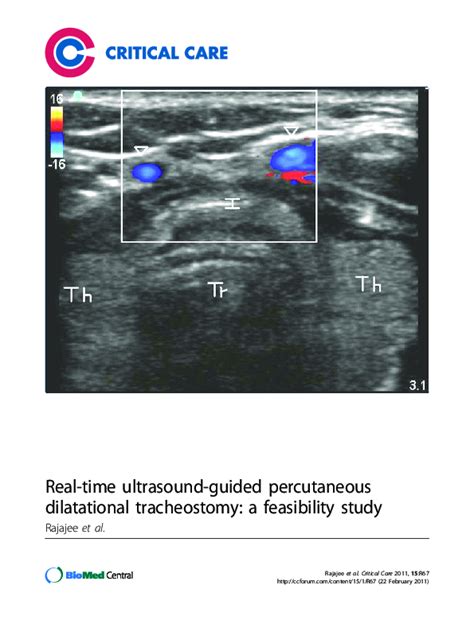 Pdf Real Time Ultrasound Guided Percutaneous Dilatational