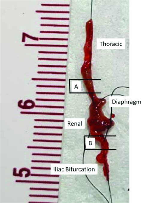 Extracted Mouse Aorta With Labeled Aortic Landmarks And Sections