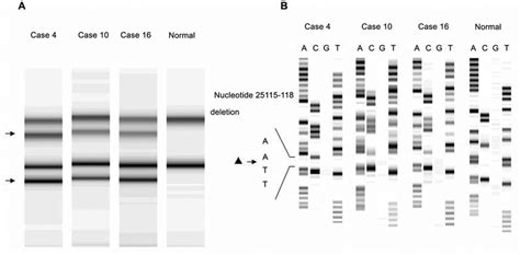 A Sscp Analysis Of The Pcr Products Derived From Primer Set 19