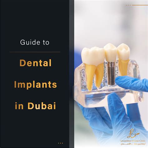 The Ultimate Guide To Dental Implants In Dubai Cost Benefits And