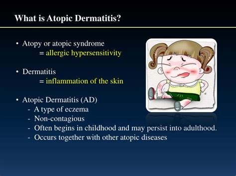 PPT - Causes and Treatment of Atopic Dermatitis PowerPoint Presentation ...